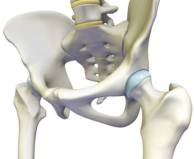 Osteokondroos põhjustab puusaliigeses teravat valu